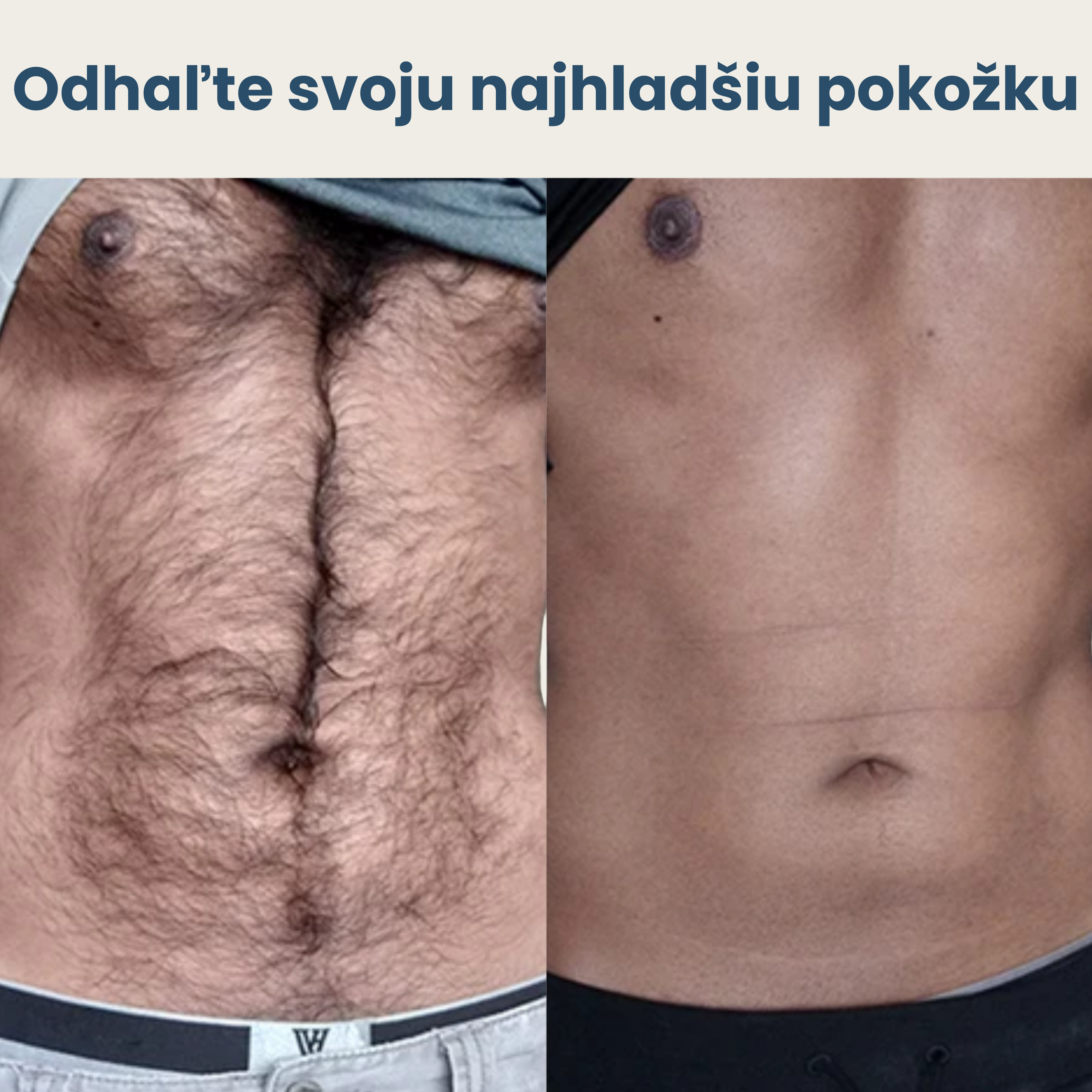 Sprej na odstraňovanie chĺpkov